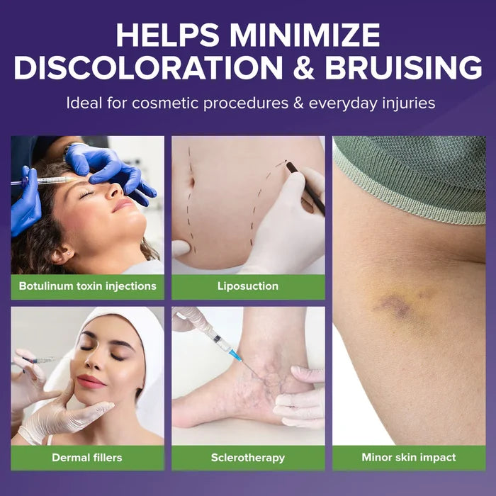 Biocorneum Advanced Bruise Dietary Supplement