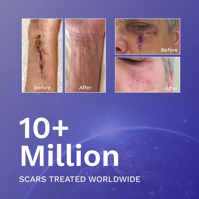 RejûvaSil Silicone Scar Gel 1 oz (8000)
