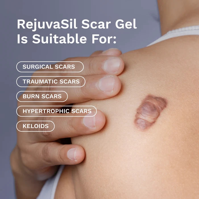 RejûvaSil Silicone Scar Gel 1 oz (8000)