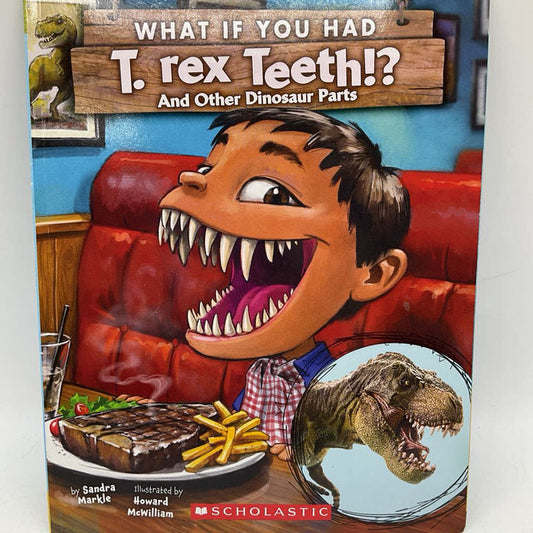 What If You Had T-Rex Teeth (paperback)